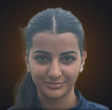 एल्पिडा कैलस