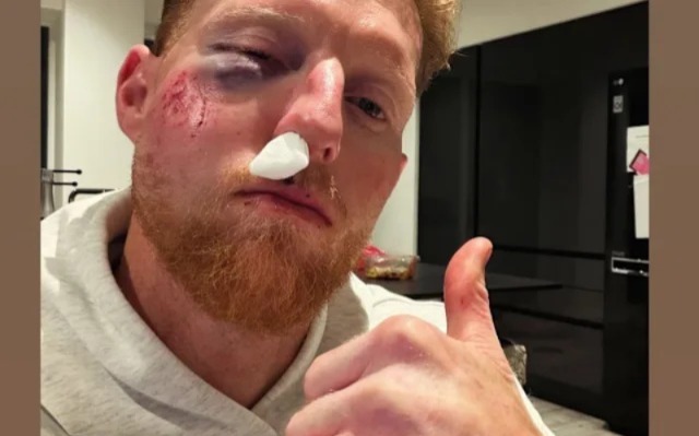 Ben Stokes Injury Update: క్రికెట్ బంతి తగిలి బెన్ స్టోక్స్‌కు ముఖానికి తీవ్ర గాయం 